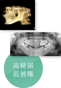 高精細低被曝