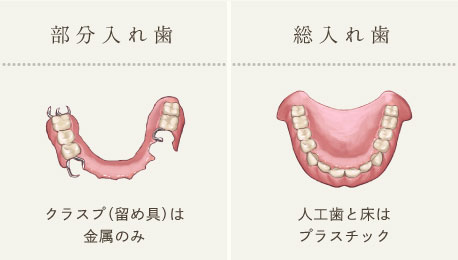 部分入れ歯：クラスプ（留め具）は金属のみ、総入れ歯：人工歯と床はプラスチック